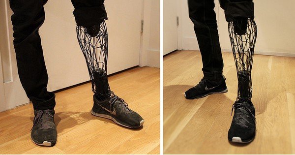 3D Tarama Teknolojisi